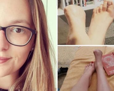 ŽENE ČUVAJTE SE! Pedikir KOJI je JAKO POPULARAN može DOVESTI DO JEZIVIH POSLEDICA! Ova DEVOJKA prenosi UŽASNO ISKUSTVO!