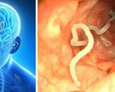 OVA HRANA MOŽE IZAZVATI POJAVU CRVA U MOZGU: Šokantne informacije su zabrinule CELU PLANETU! OVO JE UŽAS! OVA HRANA MOŽE IZAZVATI POJAVU CRVA U MOZGU: Šokantne informacije su zabrinule CELU PLANETU! OVO JE UŽAS!