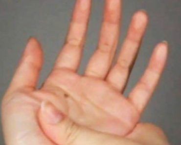 PRVI SIMPTOM RAKA POJAVLJUJE SE NA RUKAMA: Dovoljna vam je 1 STVAR da ga PREPOZNATE! PRVI SIMPTOM RAKA POJAVLJUJE SE NA RUKAMA: Dovoljna vam je 1 STVAR da ga PREPOZNATE!