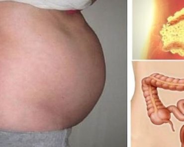UKOLIKO IMATE OVE SIMPTOME, ZNAČI DA SU VAŠA CREVA PUNA OTROVA! Odmah ćete se OČISTITI ako JEDETE OVE NAMIRNICE UKOLIKO IMATE OVE SIMPTOME, ZNAČI DA SU VAŠA CREVA PUNA OTROVA! Odmah ćete se OČISTITI ako JEDETE OVE NAMIRNICE