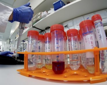 OGLASILO SE MINISTARSTVO ZDRAVLJA Ovo je situacija oko koronavirusa u Srbiji OGLASILO SE MINISTARSTVO ZDRAVLJA Ovo je situacija oko koronavirusa u Srbiji