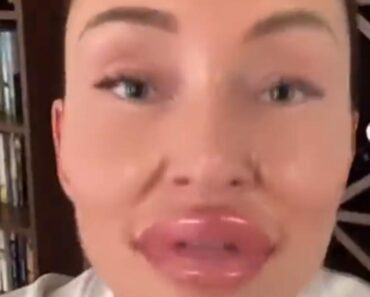 Jagodice kao dve BRESKVE, usta do pola glave, a sve zbog BITNE PORUKE!