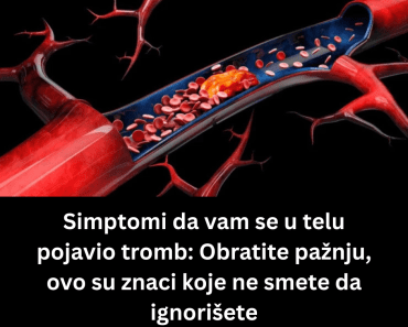 Simptomi da vam se u telu pojavio tromb: Obratite pažnju, ovo su znaci koje ne smete da ignorišete