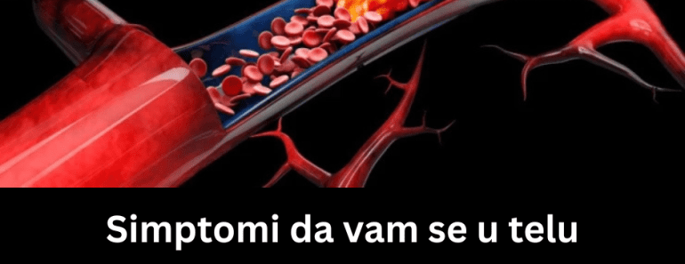 Simptomi da vam se u telu pojavio tromb: Obratite pažnju, ovo su znaci koje ne smete da ignorišete