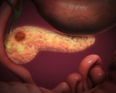 OVA 4 SIMPTOMA UKAZUJU DA IMATE RAK PANKREASA! Svrab je jedan od njih – a tek da čujete ostala tri