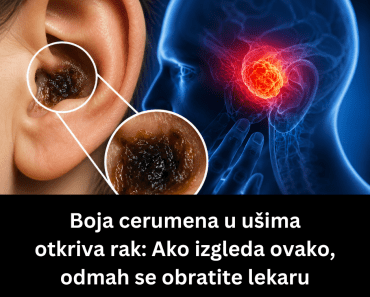 Boja cerumena u ušima otkriva rak: Ako izgleda ovako, odmah se obratite lekaru