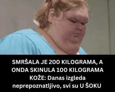 SMRŠALA JE 200 KILOGRAMA, A ONDA SKINULA 100 KILOGRAMA KOŽE: Danas izgleda neprepoznatljivo, svi su U ŠOKU (FOTO)