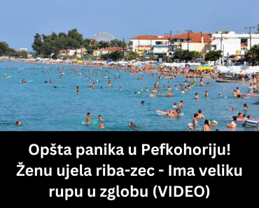 Opšta panika u Pefkohoriju! Ženu ujela riba-zec – Ima veliku rupu u zglobu (VIDEO)