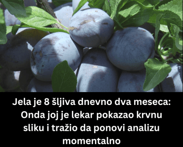 Jela je 8 šljiva dnevno dva meseca: Onda joj je lekar pokazao krvnu sliku i tražio da ponovi analizu momentalno